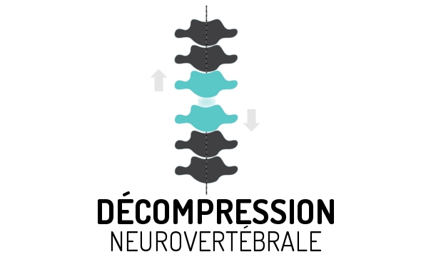 Décompression neurovertébrale